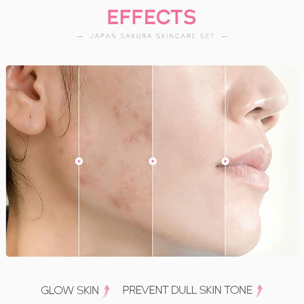 Sakura Cherry Blossom Skincare Set - 3-Piece or 5-Piece Hydrating Gift Box